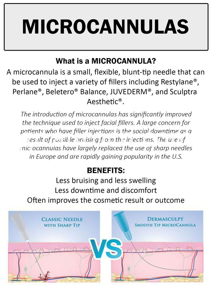 μικροκανονάλα microcannulas